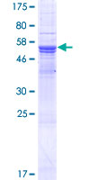 DPCR1 Protein - 12.5% SDS-PAGE of human DPCR1 stained with Coomassie Blue