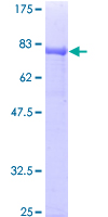 DPH2 Protein - 12.5% SDS-PAGE of human DPH2 stained with Coomassie Blue