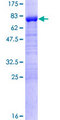 DPH2 Protein - 12.5% SDS-PAGE of human DPH2 stained with Coomassie Blue
