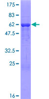 DPH5 Protein - 12.5% SDS-PAGE of human DPH5 stained with Coomassie Blue