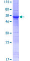 DPH6 / ATPBD4 Protein - 12.5% SDS-PAGE of human ATPBD4 stained with Coomassie Blue