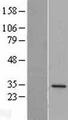 DPM1 Protein - Western validation with an anti-DDK antibody * L: Control HEK293 lysate R: Over-expression lysate