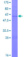 DPM1 Protein - 12.5% SDS-PAGE of human DPM1 stained with Coomassie Blue