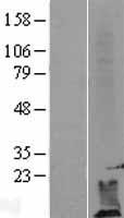 DPM2 Protein - Western validation with an anti-DDK antibody * L: Control HEK293 lysate R: Over-expression lysate