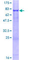 DPP2 / DPP7 Protein - 12.5% SDS-PAGE of human DPP7 stained with Coomassie Blue