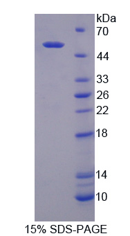 DPP2 / DPP7 Protein - Recombinant Dipeptidyl Peptidase 7 By SDS-PAGE