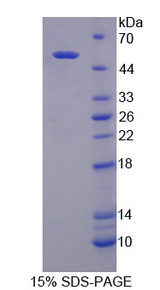 DPP2 / DPP7 Protein - Recombinant Dipeptidyl Peptidase 7 By SDS-PAGE