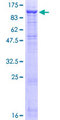 DPP4 / CD26 Protein - 12.5% SDS-PAGE of human DPP4 stained with Coomassie Blue