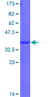 DPP4 / CD26 Protein - 12.5% SDS-PAGE Stained with Coomassie Blue.