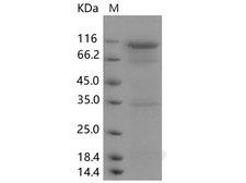DPP4 / CD26 Protein - Recombinant Human DPP4/CD26 Protein(Active)