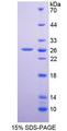 DPP6 / Dipeptidylpeptidase 6 Protein - Recombinant  Dipeptidyl Peptidase 6 By SDS-PAGE