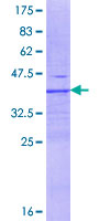 DPP9 Protein - 12.5% SDS-PAGE Stained with Coomassie Blue.