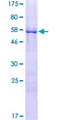 DPPA2 Protein - 12.5% SDS-PAGE of human DPPA2 stained with Coomassie Blue
