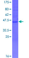 DPPL1 / PPAPDC1B Protein - 12.5% SDS-PAGE of human PPAPDC1B stained with Coomassie Blue