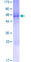 DPR2 / DACT2 Protein - 12.5% SDS-PAGE of human DACT2 stained with Coomassie Blue