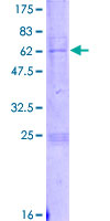 DPS / PDSS1 Protein - 12.5% SDS-PAGE of human PDSS1 stained with Coomassie Blue