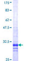 DPS / PDSS1 Protein - 12.5% SDS-PAGE Stained with Coomassie Blue.