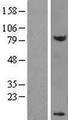DPY30 Protein - Western validation with an anti-DDK antibody * L: Control HEK293 lysate R: Over-expression lysate