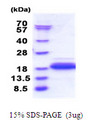 DPY30 Protein