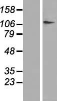 DPYD / DPD Protein - Western validation with an anti-DDK antibody * L: Control HEK293 lysate R: Over-expression lysate