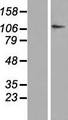 DPYD / DPD Protein - Western validation with an anti-DDK antibody * L: Control HEK293 lysate R: Over-expression lysate