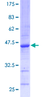 DPYD / DPD Protein - 12.5% SDS-PAGE of human DPYD stained with Coomassie Blue