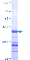 DPYD / DPD Protein - 12.5% SDS-PAGE Stained with Coomassie Blue.