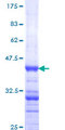 DPYD / DPD Protein - 12.5% SDS-PAGE Stained with Coomassie Blue.