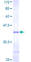 DPYS / Dihydropyrimidinase Protein - 12.5% SDS-PAGE Stained with Coomassie Blue.