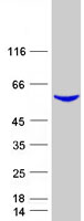 DPYS / Dihydropyrimidinase Protein - Purified recombinant protein DPYS was analyzed by SDS-PAGE gel and Coomassie Blue Staining