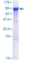 DPYSL2 / CRMP2 Protein - 12.5% SDS-PAGE of human DPYSL2 stained with Coomassie Blue