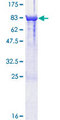 DPYSL3 / CRMP4 Protein - 12.5% SDS-PAGE of human DPYSL3 stained with Coomassie Blue