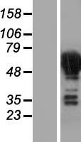 DPYSL4 / CRMP3 Protein - Western validation with an anti-DDK antibody * L: Control HEK293 lysate R: Over-expression lysate