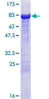 DPYSL4 / CRMP3 Protein - 12.5% SDS-PAGE of human DPYSL4 stained with Coomassie Blue