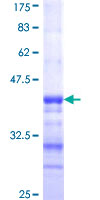 DPYSL4 / CRMP3 Protein - 12.5% SDS-PAGE Stained with Coomassie Blue.
