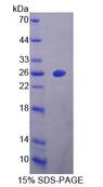 DPYSL4 / CRMP3 Protein - Recombinant Dihydropyrimidinase Like Protein 4 (DPYSL4) by SDS-PAGE