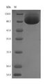 DPYSL5 / CRMP5 Protein - (Tris-Glycine gel) Discontinuous SDS-PAGE (reduced) with 5% enrichment gel and 15% separation gel.