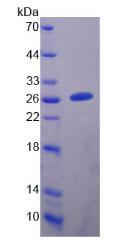 DPYSL5 / CRMP5 Protein - Recombinant Dihydropyrimidinase Like Protein 5 (DPYSL5) by SDS-PAGE