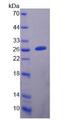 DPYSL5 / CRMP5 Protein - Recombinant Dihydropyrimidinase Like Protein 5 (DPYSL5) by SDS-PAGE