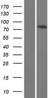 DQX1 Protein - Western validation with an anti-DDK antibody * L: Control HEK293 lysate R: Over-expression lysate