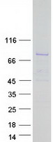 DQX1 Protein - Purified recombinant protein DQX1 was analyzed by SDS-PAGE gel and Coomassie Blue Staining