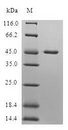 DR1 / NC2 Protein - (Tris-Glycine gel) Discontinuous SDS-PAGE (reduced) with 5% enrichment gel and 15% separation gel.