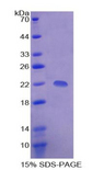 DR1 / NC2 Protein - Recombinant Down Regulator Of Transcription 1, TBP Binding By SDS-PAGE