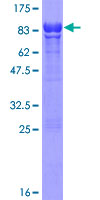 DRAK1 / STK17A Protein - 12.5% SDS-PAGE of human STK17A stained with Coomassie Blue