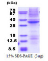 DRAK1 / STK17A Protein