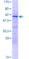 DRAP1 Protein - 12.5% SDS-PAGE of human DRAP1 stained with Coomassie Blue