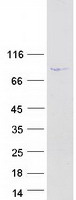 DRC1 / CCDC164 Protein - Purified recombinant protein DRC1 was analyzed by SDS-PAGE gel and Coomassie Blue Staining