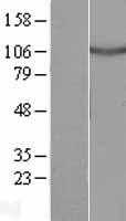 DRC7 / CCDC135 Protein - Western validation with an anti-DDK antibody * L: Control HEK293 lysate R: Over-expression lysate