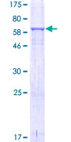 DRG1 / NEDD3 Protein - 12.5% SDS-PAGE of human DRG1 stained with Coomassie Blue