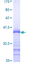 DRPLA / Atrophin-1 Protein - 12.5% SDS-PAGE Stained with Coomassie Blue.